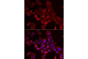 anti-Myotilin (MYOT) (AA 259-314) antibody