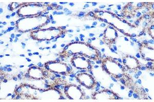 Immunohistochemistry of paraffin-embedded Mouse kidney using TSG101 Polyclonal Antibody at dilution of 1:100 (40x lens).