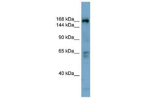 Western Blot showing DOCK2 antibody used at a concentration of 1-2 ug/ml to detect its target protein. (DOCK2 anticorps  (Middle Region))