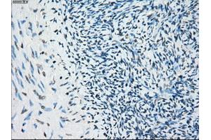Immunohistochemical staining of paraffin-embedded colon tissue using anti-BUB1Bmouse monoclonal antibody. (BUB1B anticorps)