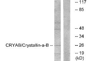 Western blot analysis of extracts from K562 cells, treated with Ca2+ (40nM, 30mins), using CRYAB/Crystallin-α-B (Ab-59) antibody. (CRYAB anticorps)