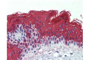 Immunohistochemistry (IHC) image for anti-Keratin 1 (KRT1) (Middle Region) antibody (ABIN2775333)