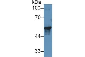 Western blot analysis of Pig Skin lysate, using Human KRT17 Antibody (1 µg/ml) and HRP-conjugated Goat Anti-Rabbit antibody ( (KRT17 anticorps  (AA 252-393))