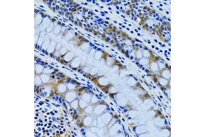Immunohistochemistry of paraffin-embedded human colon using IMPA1 antibody (ABIN2563424) at dilution of 1:100 (40x lens). (IMPA1 anticorps)