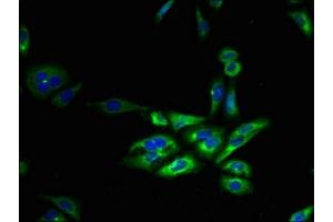 Immunofluorescent analysis of HepG2 cells using ABIN7153167 at dilution of 1:100 and Alexa Fluor 488-congugated AffiniPure Goat Anti-Rabbit IgG(H+L) (FFAR3 anticorps  (AA 280-346))