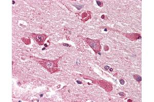 Anti-MYO1B / Myosin IB antibody IHC staining of human brain, cortex. (Myosin IB anticorps  (AA 327-339))
