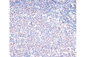 Immunohistochemistry of paraffin-embedded Rat spleen using Phospho-BRCA1(S1423) Polyclonal Antibody at dilution of 1:100 (40x lens).