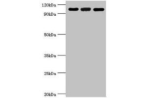 Western blot All lanes: 116 kDa U5 small nuclear ribonucleoprotein component antibody at 3 μg/mL Lane 1: Hela whole cell lysate Lane 2: 293T whole cell lysate Lane 3: NIH/3T3 whole cell lysate Secondary Goat polyclonal to rabbit IgG at 1/10000 dilution Predicted band size: 47, 44, 37 kDa Observed band size: 109 kDa