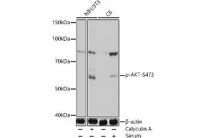 Western blot analysis of extracts of various cell lines, using Phospho-Akt-S473 antibody (ABIN7265523) at 1:1000 dilution. (AKT 1/2/3 anticorps  (pSer472))