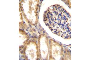 DDR1 Antibody (N-term) A immunohistochemistry analysis in formalin fixed and paraffin embedded human kidney tissue followed by peroxidase conjugation of the secondary antibody and DAB staining. (DDR1 anticorps  (N-Term))