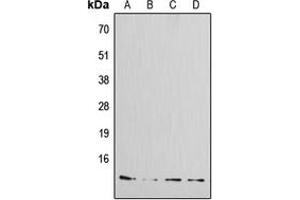 Western blot analysis of Amylin expression in MCF7 (A), HeLa (B), mouse kidney (C), rat kidney (D) whole cell lysates. (Amylin/DAP anticorps  (N-Term))