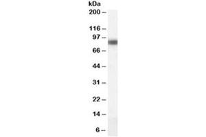 Western blot testing of human liver lysate with CPT1A antibody at 0. (CPT1A anticorps)