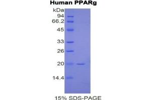 SDS-PAGE analysis of Human PPARG Protein. (PPARG Protéine)