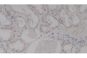 Detection of TAGLN2 in Human Kidney Tissue using Polyclonal Antibody to Transgelin 2 (TAGLN2) (TAGLN2 anticorps  (AA 2-199))
