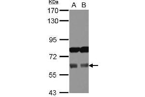 WB Image Sample (30 ug of whole cell lysate) A: 293T B: A431 7.