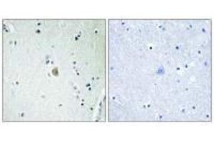 Immunohistochemistry analysis of paraffin-embedded human brain tissue, using Cytochrome P450 2E1 antibody.
