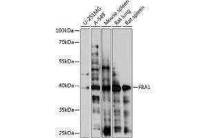 Western blot analysis of extracts of various cell lines, using F8 antibody (4806) at 1:1000 dilution. (Coagulation Factor VIII-Associated 1 (F8A1) (AA 150-250) anticorps)