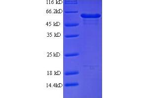 DEAD (Asp-Glu-Ala-Asp) Box Polypeptide 58 (DDX58) (AA 1-430), (ATP-binding domain) protein (His tag)