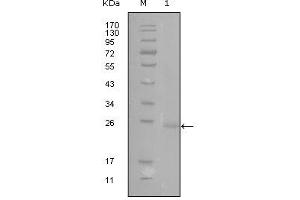 Western blot analysis using GATA3 mouse mAb against truncated GATA3-His recombinant protein (1). (GATA3 anticorps)