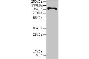 HKDC1 anticorps  (AA 129-427)