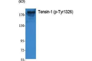 Western Blotting (WB) image for anti-Tensin 1 (TNS1) (pTyr1326) antibody (ABIN3173571) (Tensin 1 anticorps  (pTyr1326))