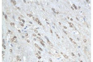 Formalin-fixed and paraffin embedded rat colitis labeled with Anti-phospho-MAP4(Ser941) Polyclonal Antibody, Unconjugated  followed by conjugation to the secondary antibody and DAB staining (MAP4 anticorps  (pSer941))