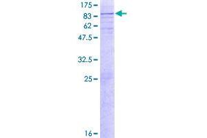 Glucosamine (N-Acetyl)-6-Sulfatase (GNS) (AA 1-552) protein (GST tag)