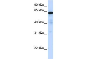 WB Suggested Anti-FOXN4 Antibody Titration:  0. (FOXN4 anticorps  (C-Term))