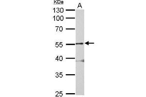 WB Image Glycine Receptor alpha 2 antibody detects GLRA2 protein by Western blot analysis. (GLRa2 anticorps)