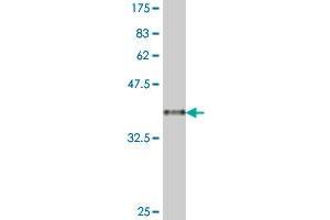 Western Blot detection against Immunogen (38.