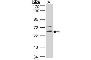WB Image Sample(30 ug whole cell lysate) A:Hep G2 , 10% SDS PAGE antibody diluted at 1:2000 (STK33 anticorps)
