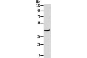 Gel: 8 % SDS-PAGE,Lysate: 40 μg,Primary antibody: ABIN7191352(MAGEB3 Antibody) at dilution 1/200 dilution,Secondary antibody: Goat anti rabbit IgG at 1/8000 dilution,Exposure time: 10 seconds (MAGEB3 anticorps)