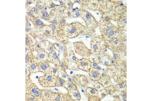 Immunohistochemistry of paraffin-embedded human liver injury using GLUD2 antibody at dilution of 1:100 (x40 lens). (GLUD2 anticorps)