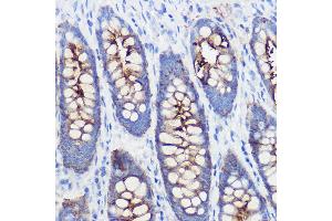 Immunohistochemistry of paraffin-embedded human colon using PIGR Rabbit pAb (ABIN6128562, ABIN6145618, ABIN6145620 and ABIN6221728) at dilution of 1:100 (40x lens).