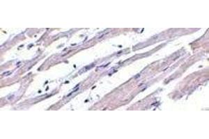 Immunohistochemistry of Apaf1 in human heart tissue with Apaf1 (NT) antibody at 1μg/ml. (APAF1 anticorps  (N-Term))