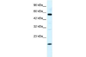 WB Suggested Anti-ZNF436 Antibody Titration:  1. (ZNF436 anticorps  (N-Term))