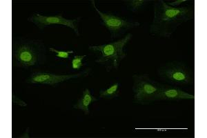 Immunofluorescence of purified MaxPab antibody to PITX1 on HeLa cell.