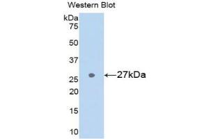Detection of Recombinant GSTa3, Rat using Polyclonal Antibody to Glutathione S Transferase Alpha 3 (GSTa3) (GSTA3 anticorps  (AA 1-221))