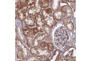 Immunohistochemical staining of human kidney with GPR113 polyclonal antibody  shows distinct cytoplasmic positivity in tubular cells at 1:50-1:200 dilution. (GPR113 anticorps)
