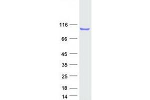 Validation with Western Blot
