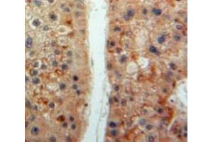 Used in DAB staining on fromalin fixed paraffin-embedded Liver tissue (Prekallikrein anticorps  (AA 156-364))