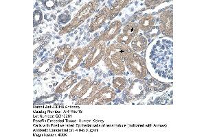 Immunohistochemistry (IHC) image for anti-Cadherin 8 (CDH8) (Middle Region) antibody (ABIN2782142) (Cadherin 8 anticorps  (Middle Region))