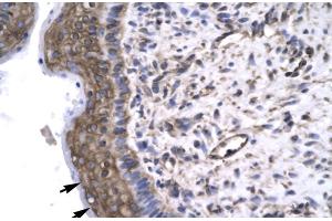 Rabbit Anti-GTF2F2 Antibody Catalog Number: ARP31437 Paraffin Embedded Tissue: Human Spermatophore Cellular Data: Epithelial cells Antibody Concentration: 4. (GTF2F2 anticorps  (Middle Region))