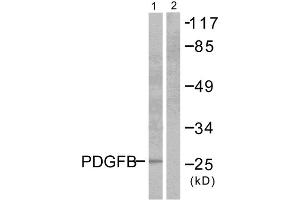 Western blot analysis of extracts from NIH/3T3 cells, using PDGFB antibody (ABIN5976488). (PDGFB anticorps  (Internal Region))