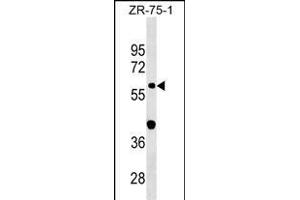 GDPD2 Antibody (Center) (ABIN1538279 and ABIN2849892) western blot analysis in ZR-75-1 cell line lysates (35 μg/lane). (GDPD2 anticorps  (AA 305-334))