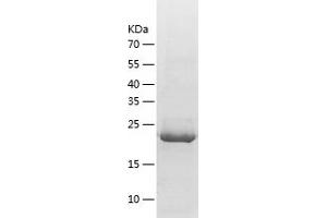Western Blotting (WB) image for Insulin-Like Growth Factor Binding Protein 4 (IGFBP4) (AA 22-258) protein (His-IF2DI Tag) (ABIN7123462)