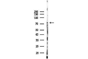 Western blot analysis of lysates from K562 cells(UV 30 min treatment), using NF-kB p65 Antibody at 1/1000 dilution.