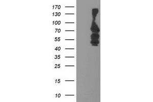 Western Blotting (WB) image for anti-Katanin P80 (WD Repeat Containing) Subunit B 1 (KATNB1) antibody (ABIN1498989) (KATNB1 anticorps)