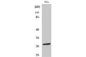 Western Blotting (WB) image for anti-B-Cell CLL/lymphoma 2 (BCL2) (pSer70) antibody (ABIN3181930) (Bcl-2 anticorps  (pSer70))