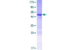 Image no. 1 for Nuclear Receptor Interacting Protein 3 (NRIP3) (AA 1-241) protein (GST tag) (ABIN1313033)